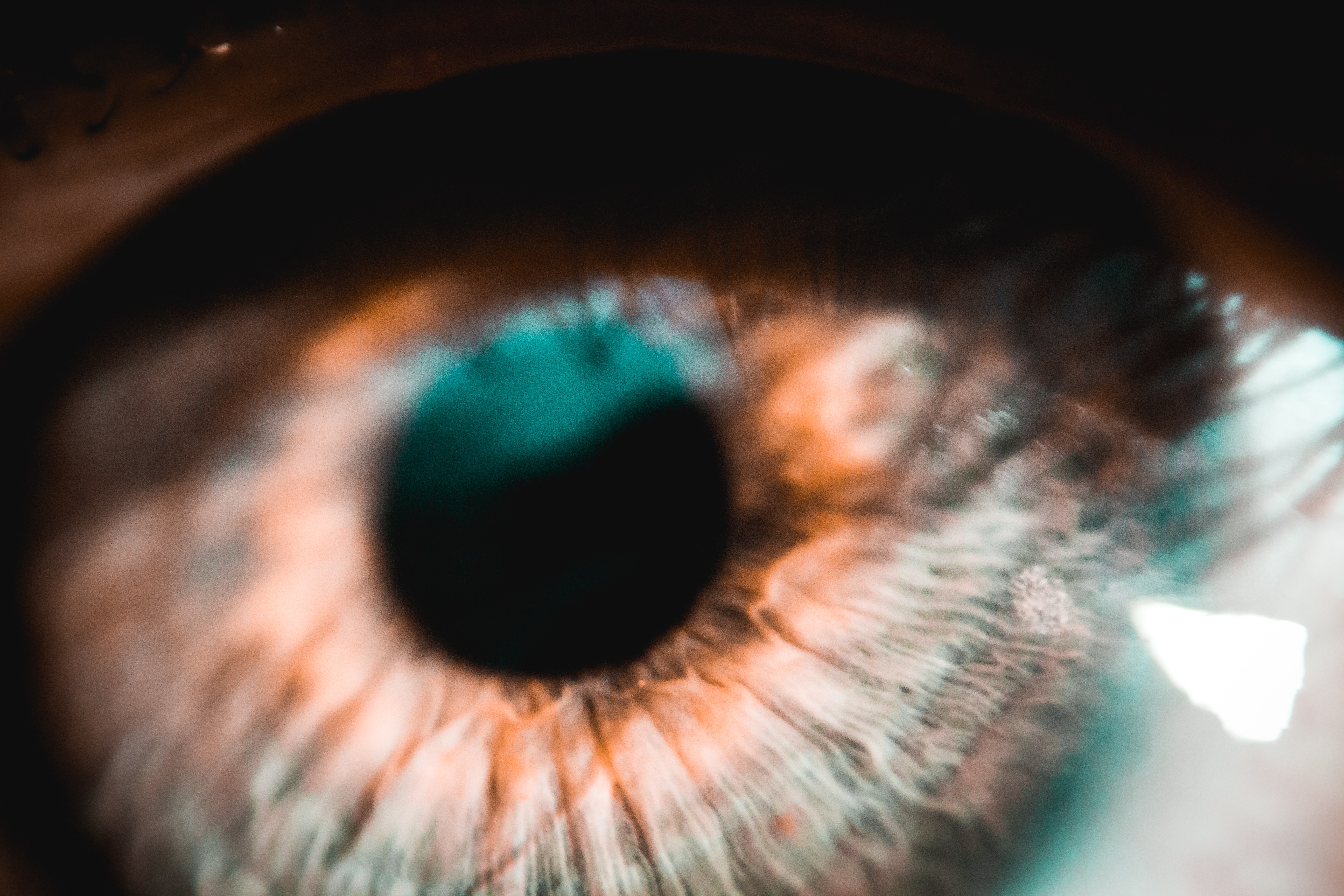 Losing vision from strokes